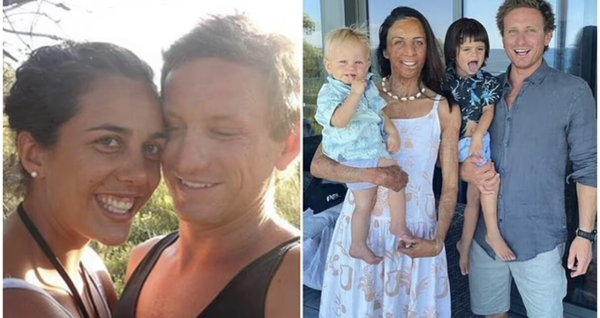 The Six Words Turia Pitt’s Husband Uttered To Doctors As The Marathon Runner Lay Dying In Her Hospital Bed After A Freak Accident