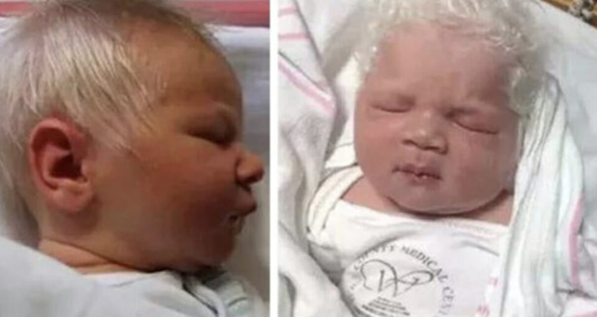 Baby Born With Full Head Of Gray Hair Wins The Hearts Of All Around Him