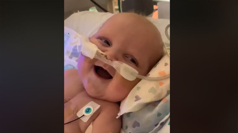 Baby Boy Smiles For The First Time After His Second Open-Heart Surgery