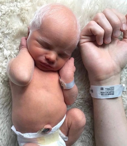 Albino baby mocked for white hair is happy and healthy years later